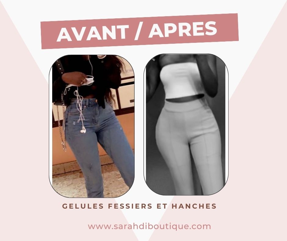 GELULES FESSES HANCHES CUISSES